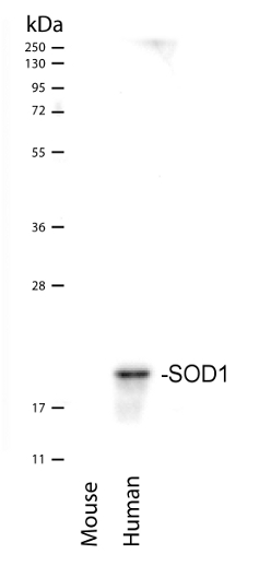 western blot using anti-SOD1 antibodies